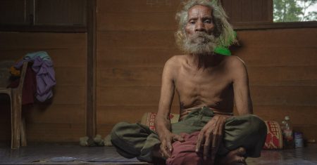 découvrez des solutions efficaces et des conseils pratiques pour lutter contre l'amincissement des cheveux. améliorez la santé de votre cuir chevelu et renforcez vos cheveux grâce à nos astuces et produits recommandés.