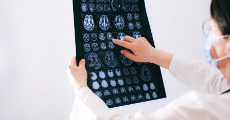 découvrez les coûts des examens irm, facteurs influençant les prix et conseils pour optimiser vos dépenses en imagerie médicale.