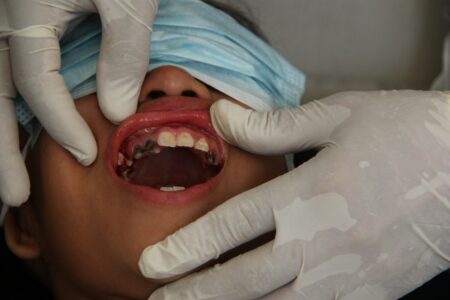 a woman getting her teeth checked by a dentist