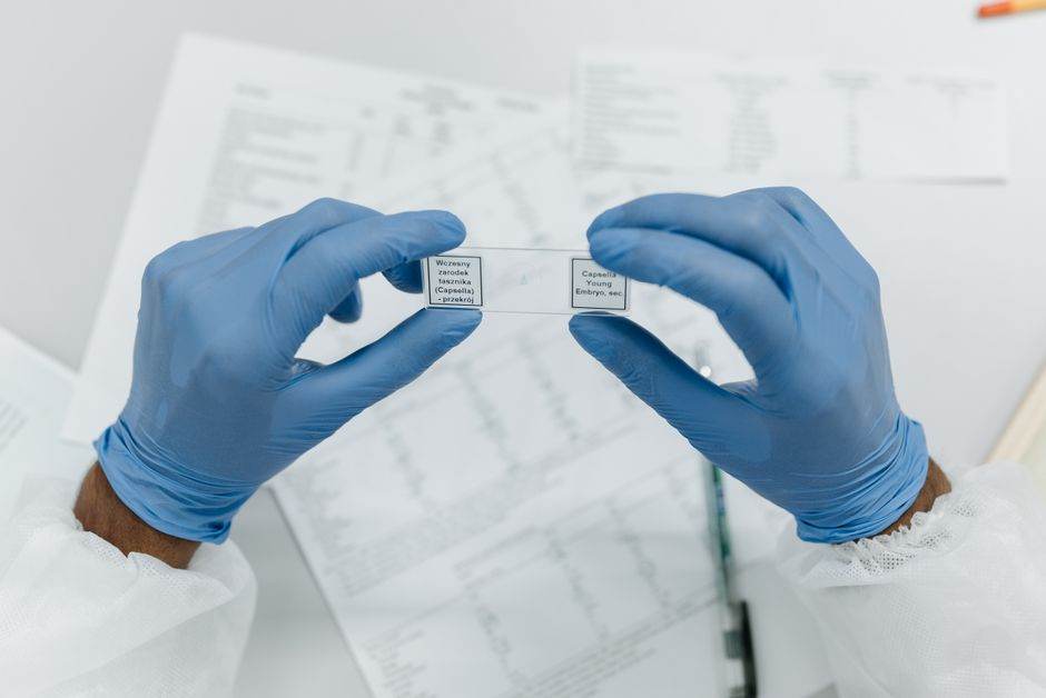 Researcher holds labeled microscope slides wearing blue gloves, in a laboratory setting.