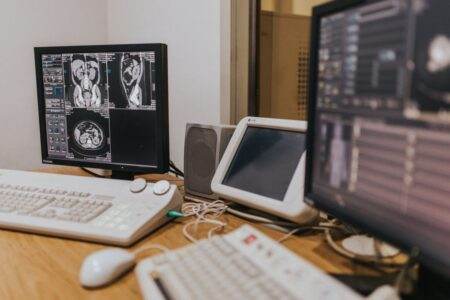 Super-résolution IA : IRM, scanner et jeu vidéo Medical imaging setup with MRI scans on multiple screens in a healthcare facility.